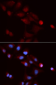 SNRPE Antibody