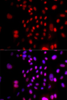 RFC4 Antibody