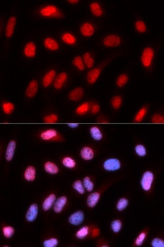 RFC4 Antibody