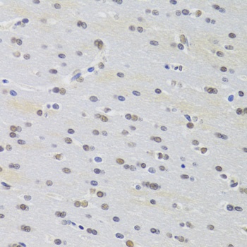 PRPF3 Antibody