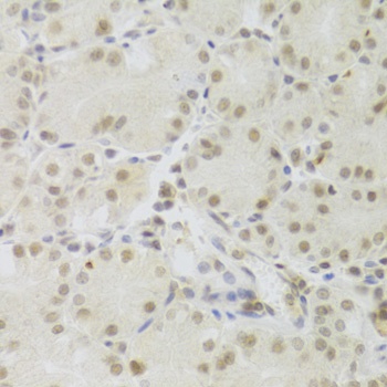 PRPF3 Antibody