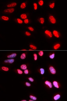 PRPF3 Antibody