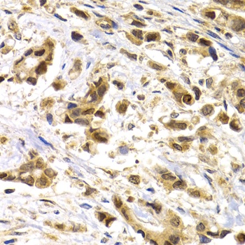 MAGEA1 Antibody