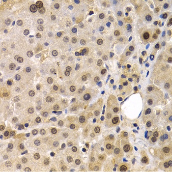 MAGEA1 Antibody