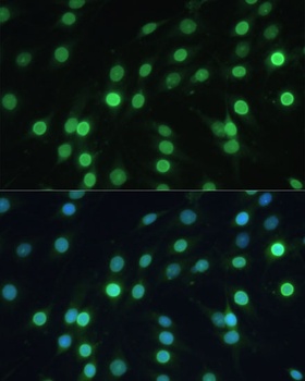 LBR Antibody