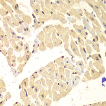 HIF1AN Antibody