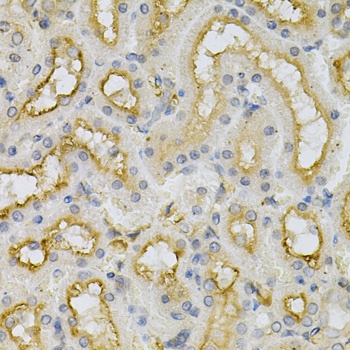 FHL1 Antibody