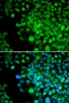 FHL1 Antibody