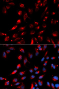 CPE Antibody