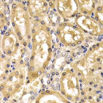 ADH4 Antibody
