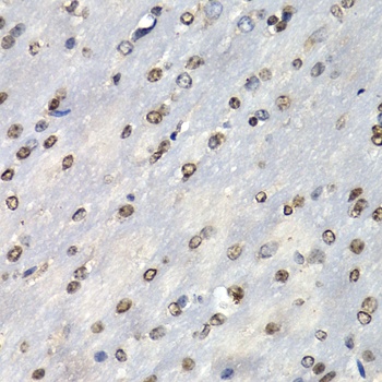 PSMB10 Antibody