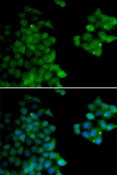 PSMB10 Antibody