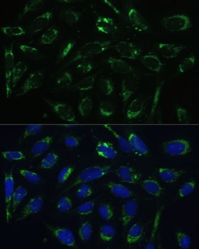 HSD17B10 Antibody