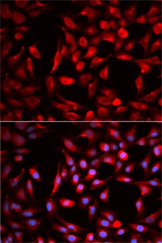 CBR1 Antibody