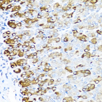 MGP Antibody