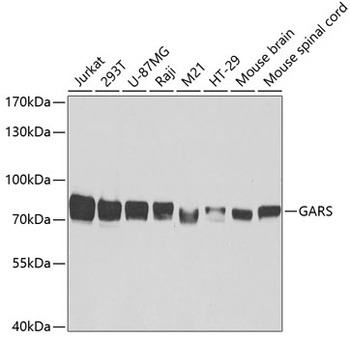 GARS Antibody