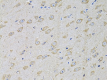 GARS Antibody