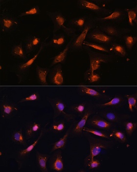 RIPK3 Antibody