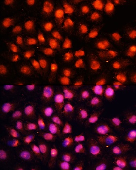 STXBP1 Antibody