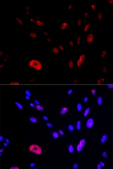 HUS1 Antibody