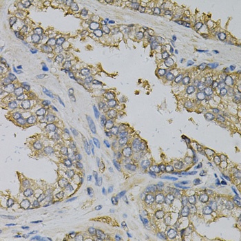 EIF4B Antibody