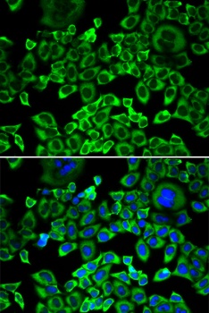 EIF4B Antibody