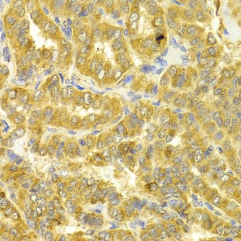DLD Antibody