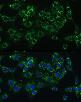 CYB5A Antibody