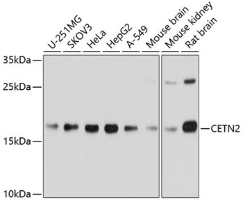 CETN2 Antibody