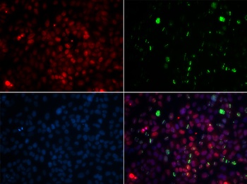 CETN2 Antibody