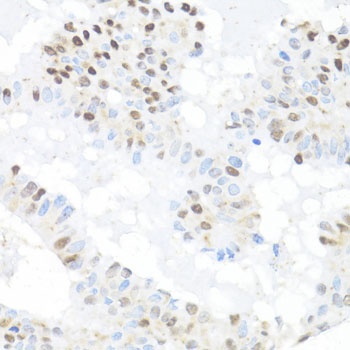 BACH1 Antibody