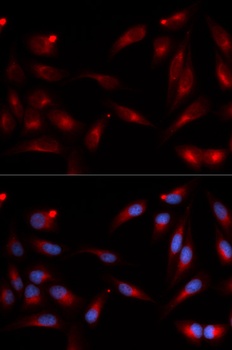 ADAM9 Antibody