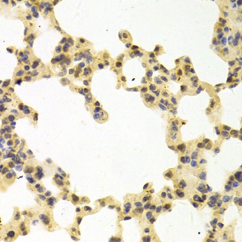 RANGAP1 Antibody