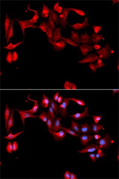 GP9 Antibody