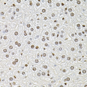 FOSL1 Antibody