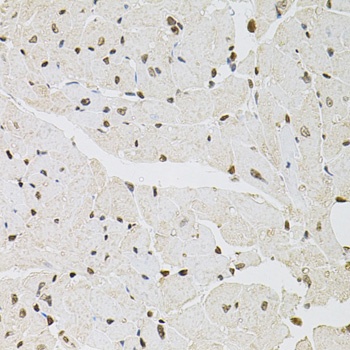 FOSL1 Antibody