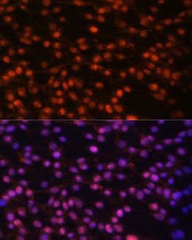 FOSL1 Antibody