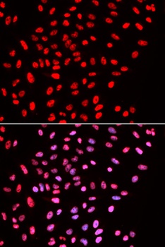 SMARCE1 Antibody