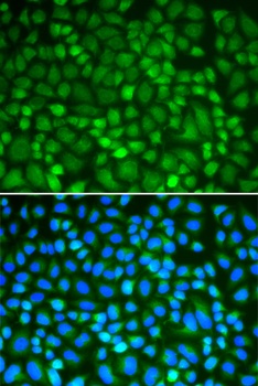 NEK2 Antibody