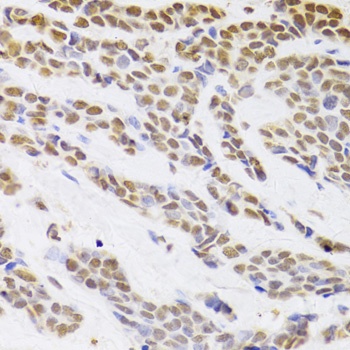 HDGF Antibody