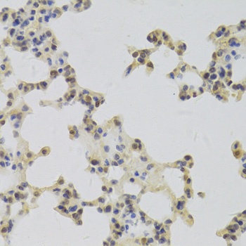 HDGF Antibody