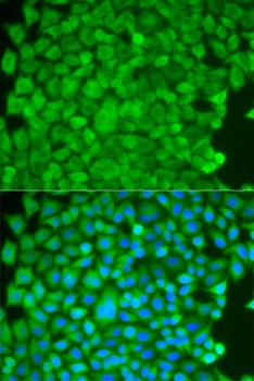 SGCE Antibody