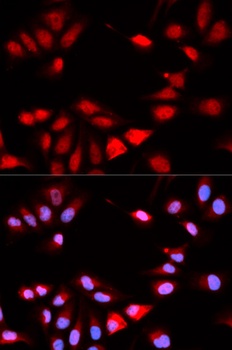 RCAN1 Antibody