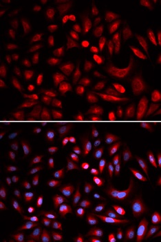 PRKACB Antibody