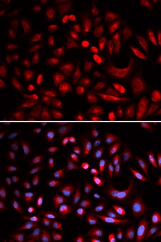 PRKACB Antibody