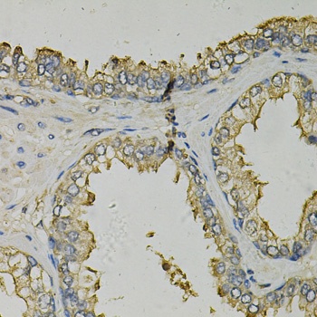 FABP1 Antibody