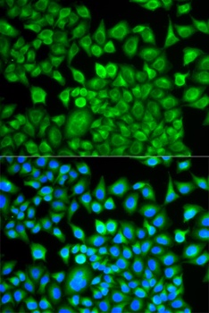 FABP1 Antibody