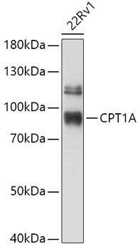 CPT1A Antibody