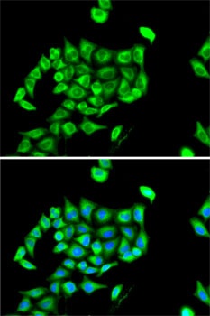 CPT1A Antibody