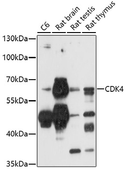 CAMK4 Antibody